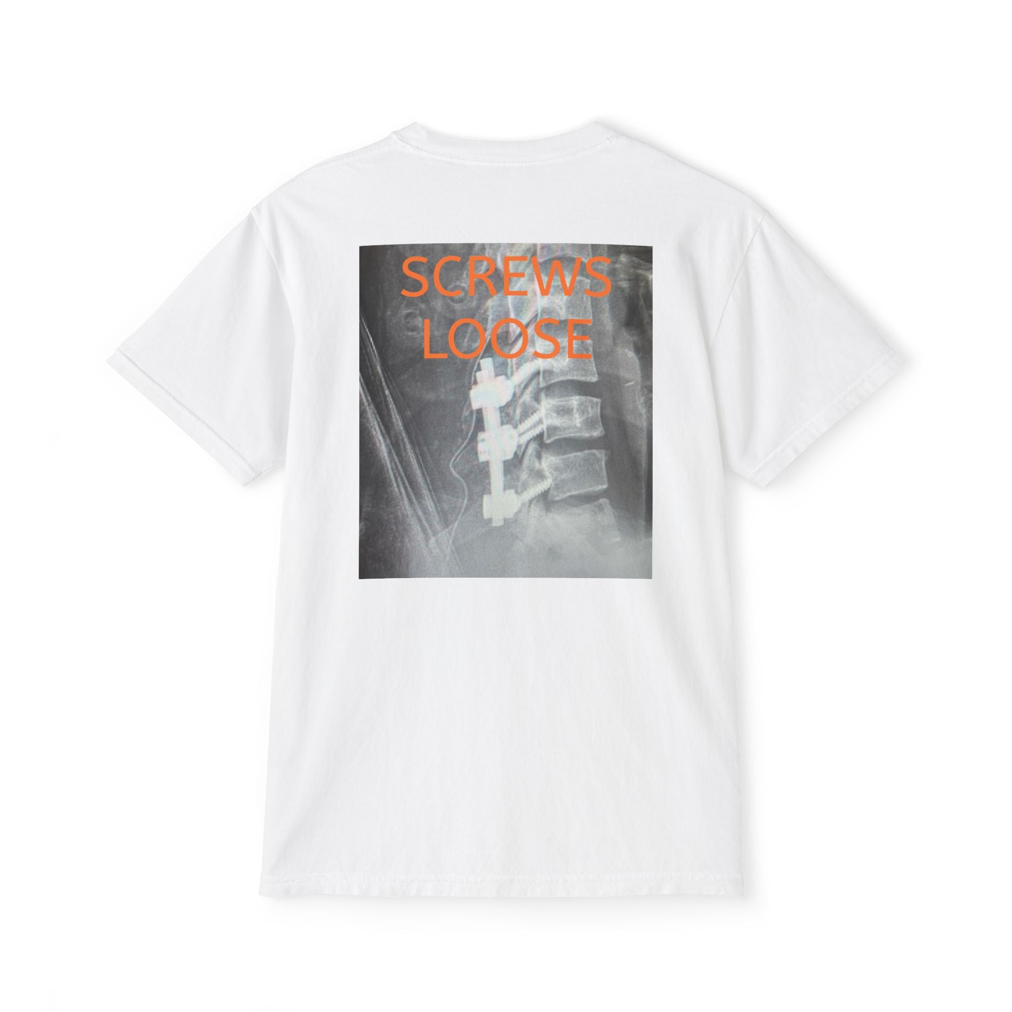Screws Loose Alternate MRI Image | All Love Co