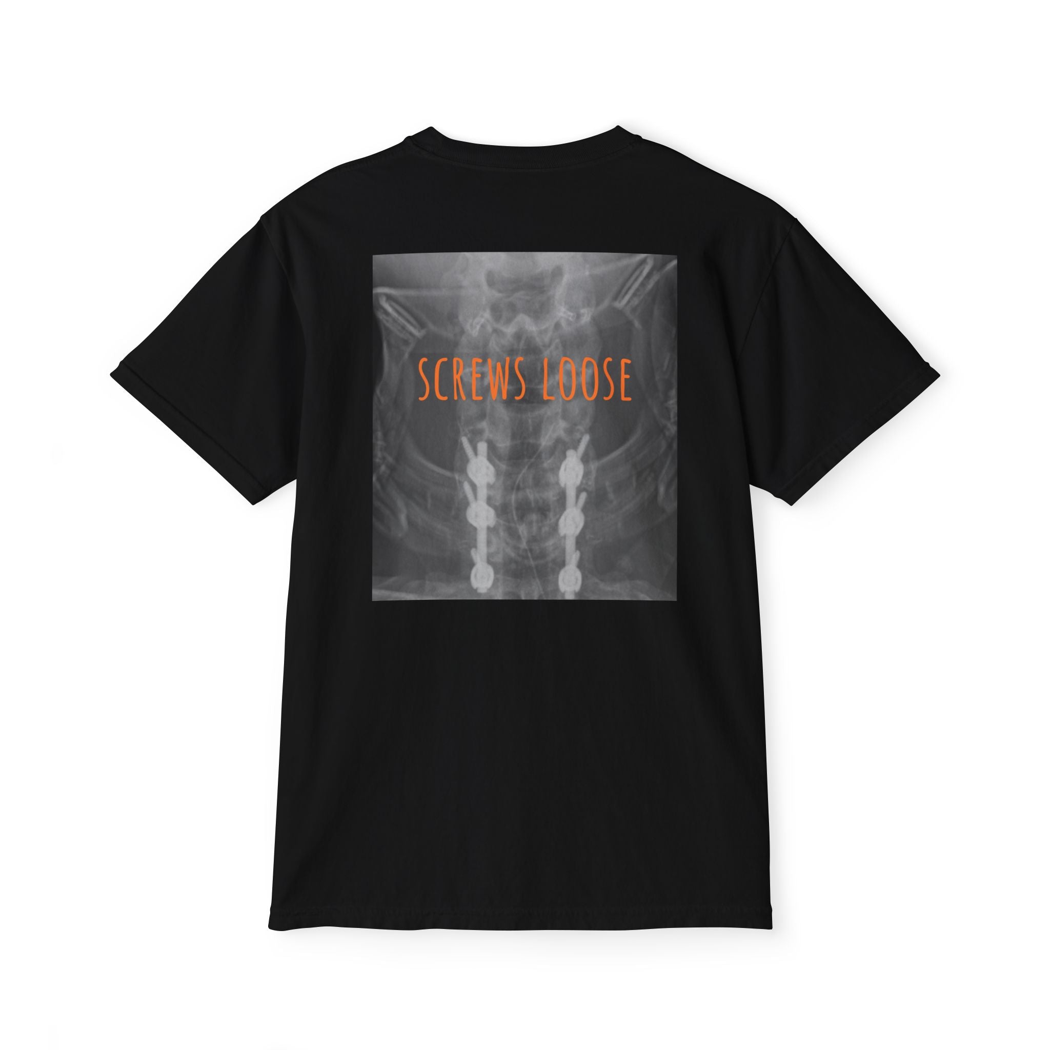 Screws Loose Tee | Real Personal Spinal Image | All Love Co